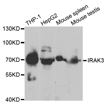 IRAK3 / IRAKM / IRAK-M Antibody - Western blot analysis of extracts of various cell lines, using IRAK3 antibody.