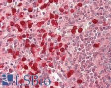 IRAK3 / IRAKM / IRAK-M Antibody - Human Spleen: Formalin-Fixed, Paraffin-Embedded (FFPE)