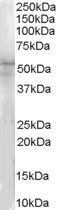 IRAK4 / IRAK-4 Antibody - IRAK4 / IRAK-4 antibody (1ug/ml) staining of HeLa lysate (35ug protein in RIPA buffer). Detected by chemiluminescence.