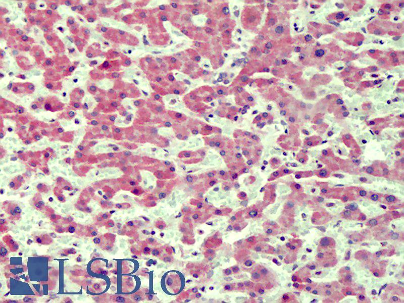 IRAK4 / IRAK-4 Antibody - Anti-IRAK4 antibody IHC of human liver. Immunohistochemistry of formalin-fixed, paraffin-embedded tissue after heat-induced antigen retrieval. Antibody concentration 3.75 ug/ml.