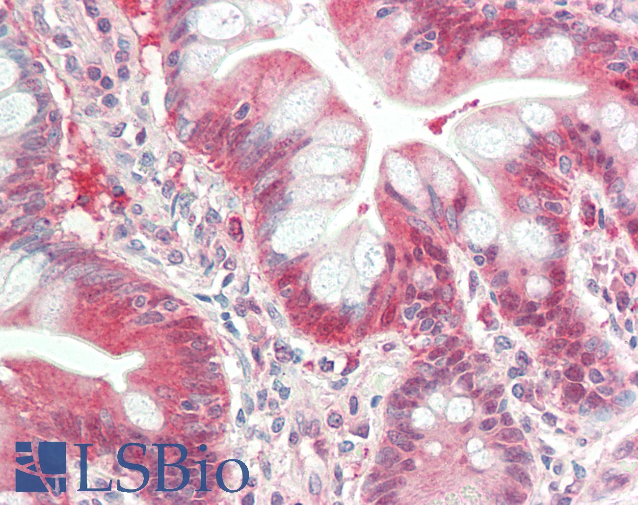 IRAK4 / IRAK-4 Antibody - Anti-IRAK4 / IRAK-4 antibody IHC staining of human small intestine. Immunohistochemistry of formalin-fixed, paraffin-embedded tissue after heat-induced antigen retrieval. Antibody dilution 1:50.