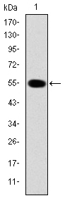 IRAK4 / IRAK-4 Antibody - Western blot using IRAK4 monoclonal antibody against human IRAK4 (AA: 21-198) recombinant protein. (Expected MW is 45.4 kDa)