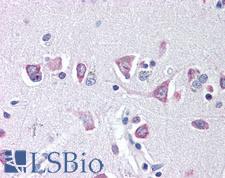IREB2 / IRP2 Antibody - Anti-IREB2 antibody IHC of human brain. Immunohistochemistry of formalin-fixed, paraffin-embedded tissue after heat-induced antigen retrieval. Antibody concentration 20 ug/ml. This image was taken for the unconjugated form of this product. Other forms have not been tested.