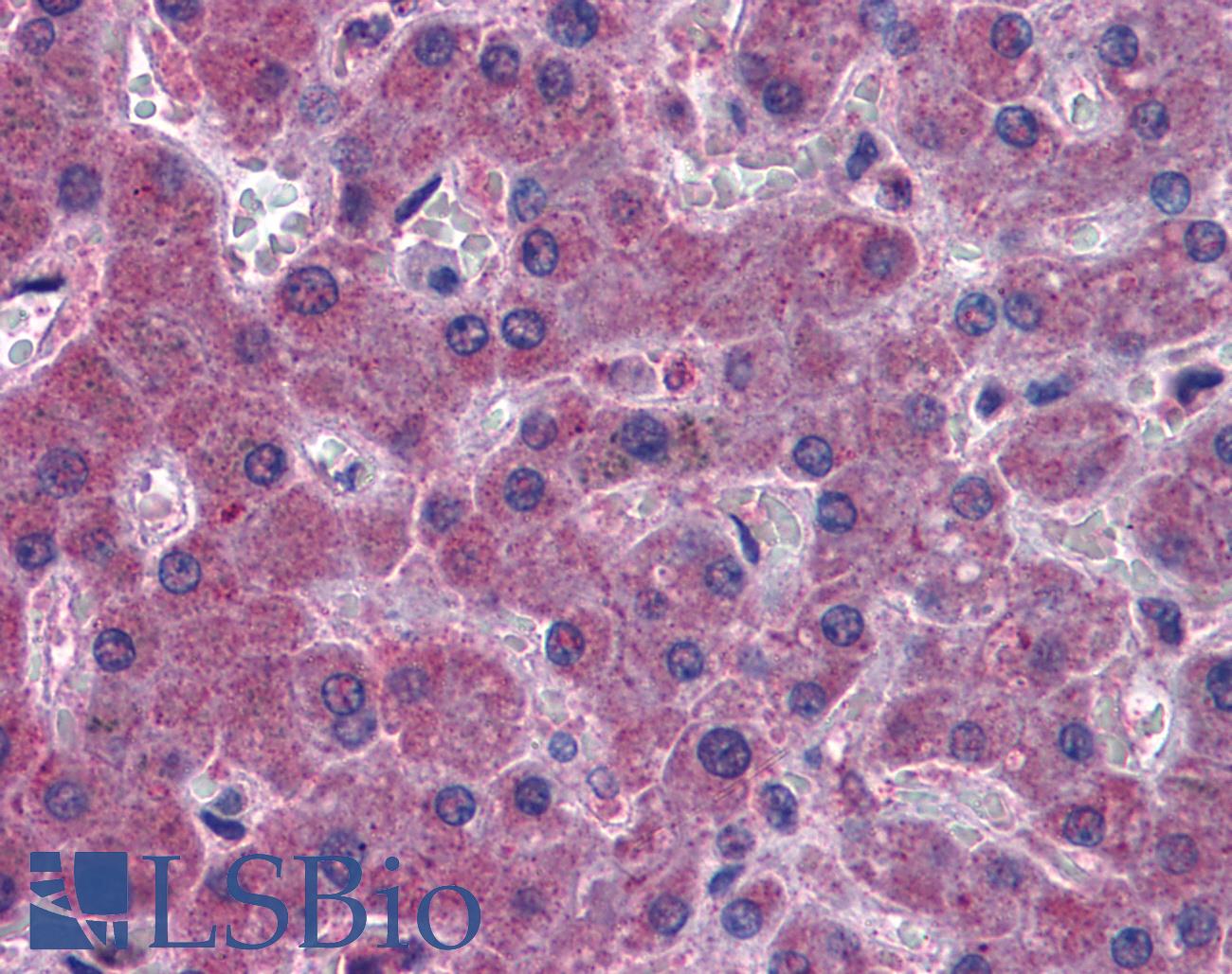 IREB2 / IRP2 Antibody - Anti-IREB2 antibody IHC of human liver. Immunohistochemistry of formalin-fixed, paraffin-embedded tissue after heat-induced antigen retrieval. Antibody concentration 3.75 ug/ml.
