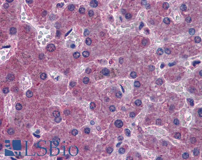 IREB2 / IRP2 Antibody - Anti-IREB2 antibody IHC of human liver. Immunohistochemistry of formalin-fixed, paraffin-embedded tissue after heat-induced antigen retrieval. Antibody concentration 3.75 ug/ml.