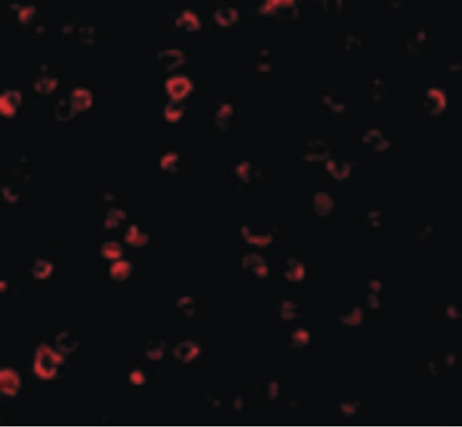 IRF3 Antibody - Immunofluorescence of IRF3 in Ramos cells with IRF3 antibody at 2 ug/ml.