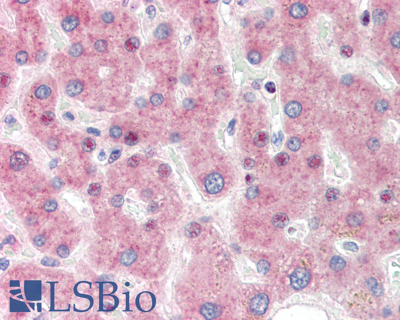 IRF3 Antibody - Anti-IRF3 antibody IHC staining of human liver. Immunohistochemistry of formalin-fixed, paraffin-embedded tissue after heat-induced antigen retrieval. Antibody dilution 1:50.