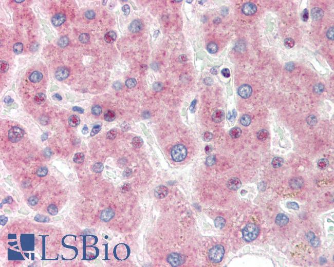 IRF3 Antibody - Anti-IRF3 antibody IHC staining of human liver. Immunohistochemistry of formalin-fixed, paraffin-embedded tissue after heat-induced antigen retrieval. Antibody dilution 1:50.
