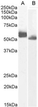 IRF4 Antibody - 0.3µg/ml staining of Human (A) and (0.1ug/ml) Rat (B) Spleen lysate (35µg protein in RIPA buffer).