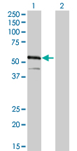 IRF4 Antibody - Western blot of IRF4 expression in transfected 293T cell line by IRF4 monoclonal antibody clone 2F2.