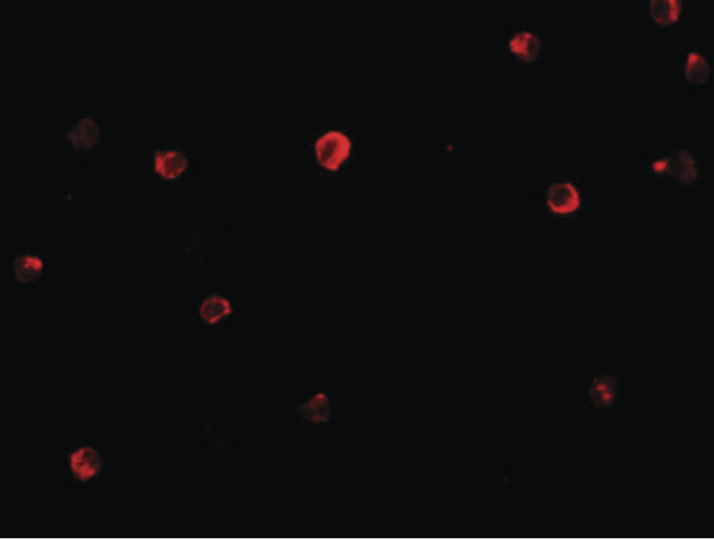 IRF4 Antibody - Immunofluorescence of IRF4 in Jurkat cells with IRF4 antibody at 20 ug/ml.