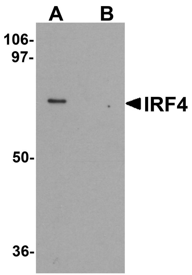 IRF4 Antibody - Western blot analysis of IRF4 in Jurkat cell lysate with IRF4 antibody at 1 ug/ml in (A) the absence and (B) the presence of blocking peptide.