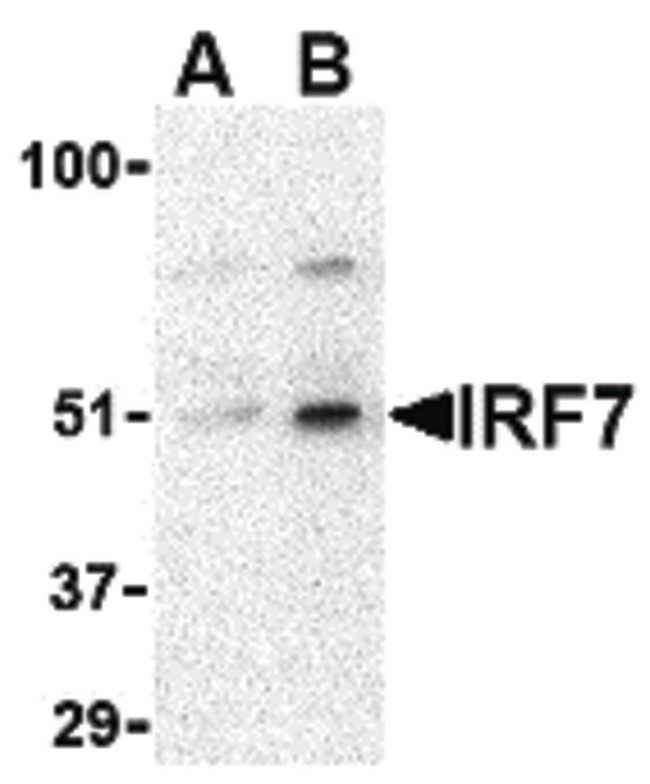 IRF7 Antibody - Western blot of IRF7 in 293 whole cell lysate with IRF7 antibody at (A) 0.5 and (B) 1 ug/ml.