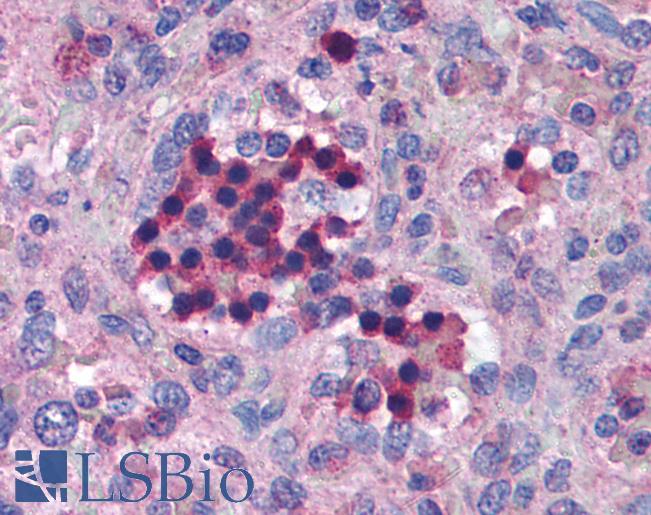 IRF7 Antibody - Anti-IRF7 antibody IHC of human spleen. Immunohistochemistry of formalin-fixed, paraffin-embedded tissue after heat-induced antigen retrieval. Antibody concentration 5 ug/ml.