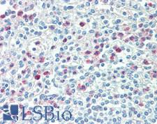 IRGM / LRG-47 Antibody - Human Spleen: Formalin-Fixed, Paraffin-Embedded (FFPE)