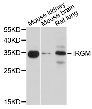 IRGM / LRG-47 Antibody - Western blot analysis of extracts of various cell lines, using IRGM antibody at 1:1000 dilution. The secondary antibody used was an HRP Goat Anti-Rabbit IgG (H+L) at 1:10000 dilution. Lysates were loaded 25ug per lane and 3% nonfat dry milk in TBST was used for blocking. An ECL Kit was used for detection and the exposure time was 90s.