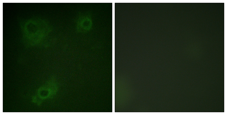 IRS1 Antibody - Immunofluorescence analysis of COS7 cells, using IRS-1 Antibody. The picture on the right is blocked with the synthesized peptide.