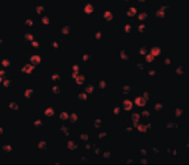 IRS1 Antibody - Immunofluorescence of IRS-1 in P815 cells with IRS-1 antibody at 2 ug/ml.
