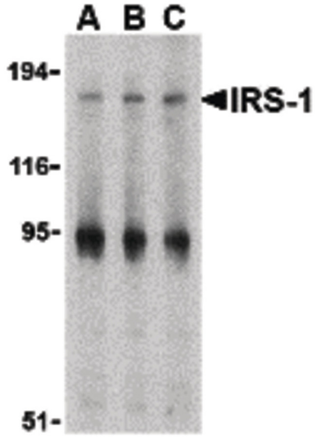 IRS1 Antibody - Western blot of IRS-1 in PC-3 cell lysate with IRS-1 antibody at (A) 1, (B) 2 and (C) 4 ug/ml.