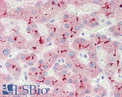 IRS2 / IRS-2 Antibody - Human Liver: Formalin-Fixed, Paraffin-Embedded (FFPE), at a dilution of 1:100.