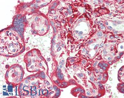 IRS2 / IRS-2 Antibody - Human Placenta: Formalin-Fixed, Paraffin-Embedded (FFPE), at a concentration of 5 ug/ml.