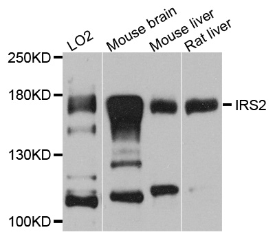 IRS2 / IRS-2 Antibody - Western blot blot of extracts of various cells, using IRS2 antibody.