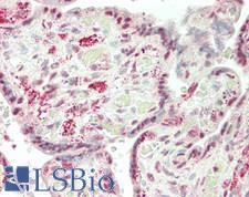 IRX2 Antibody - Human Placenta: Formalin-Fixed, Paraffin-Embedded (FFPE)