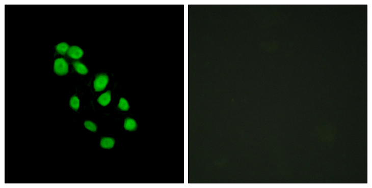 IRX2 Antibody - Immunofluorescence analysis of HepG2 cells, using IRX2 Antibody. The picture on the right is blocked with the synthesized peptide.