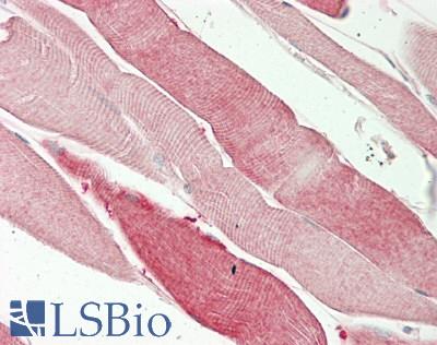 ISCU Antibody - Human Skeletal Muscle: Formalin-Fixed, Paraffin-Embedded (FFPE)