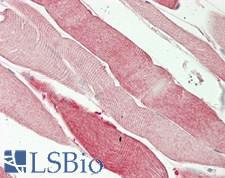 ISCU Antibody - Human Skeletal Muscle: Formalin-Fixed, Paraffin-Embedded (FFPE)