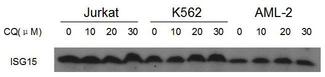 ISG15 Antibody - ISG15 Antibody western blot of Jurkat? K562 and AML-2 cell line lysates treated with a small molecular of 0?10?20?30uM for 24 hours.(Offered friendly by Biyin Cao, Soochow University, Center for Blood Research)