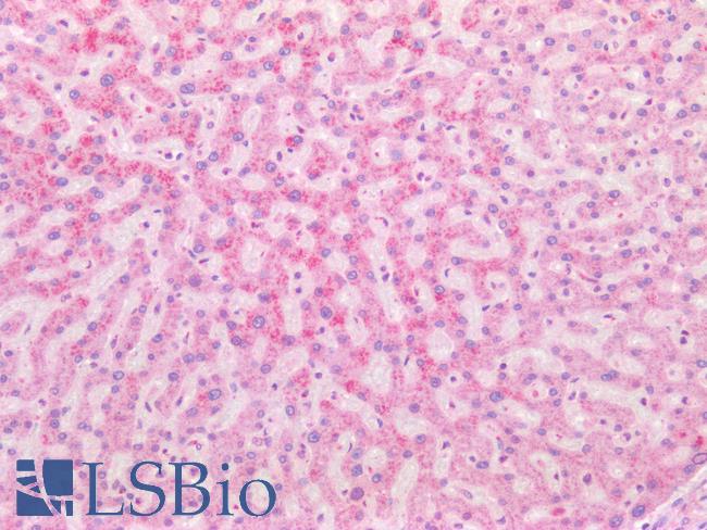 ISG15 Antibody - Human Liver: Formalin-Fixed, Paraffin-Embedded (FFPE)