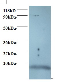 ISG15 Antibody - Western blot of Ubiquitin-like protein ISG15 antibody at 2 ug/ml + 293T whole cell lysate. Secondary: Goat polyclonal to Rabbit IgG at 1:15000 dilution. Predicted band size: 18 kDa. Observed band size: 18 kDa.  This image was taken for the unconjugated form of this product. Other forms have not been tested.