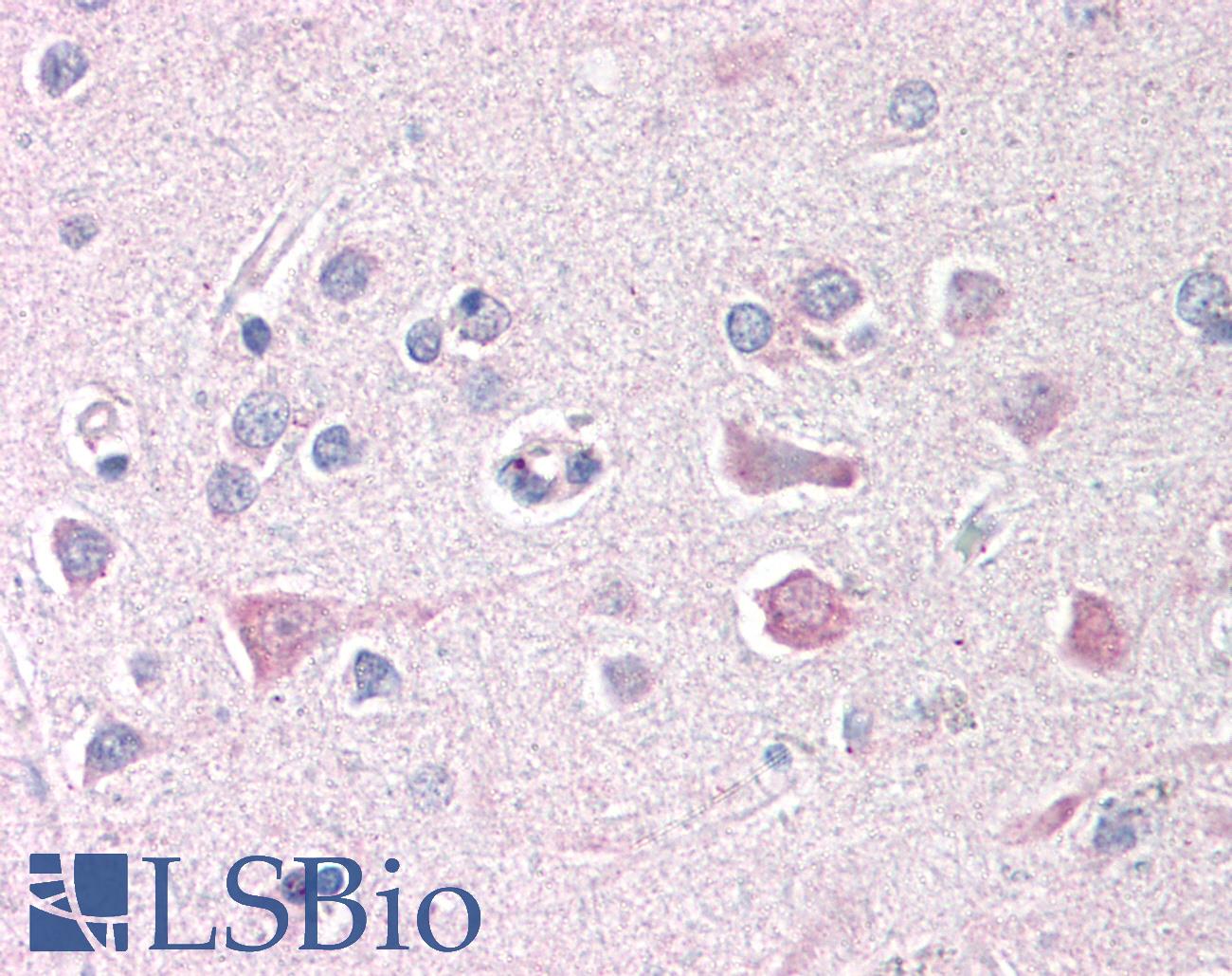 ISG15 Antibody - Anti-ISG15 antibody IHC of human brain, cortex. Immunohistochemistry of formalin-fixed, paraffin-embedded tissue after heat-induced antigen retrieval. Antibody concentration 20 ug/ml.