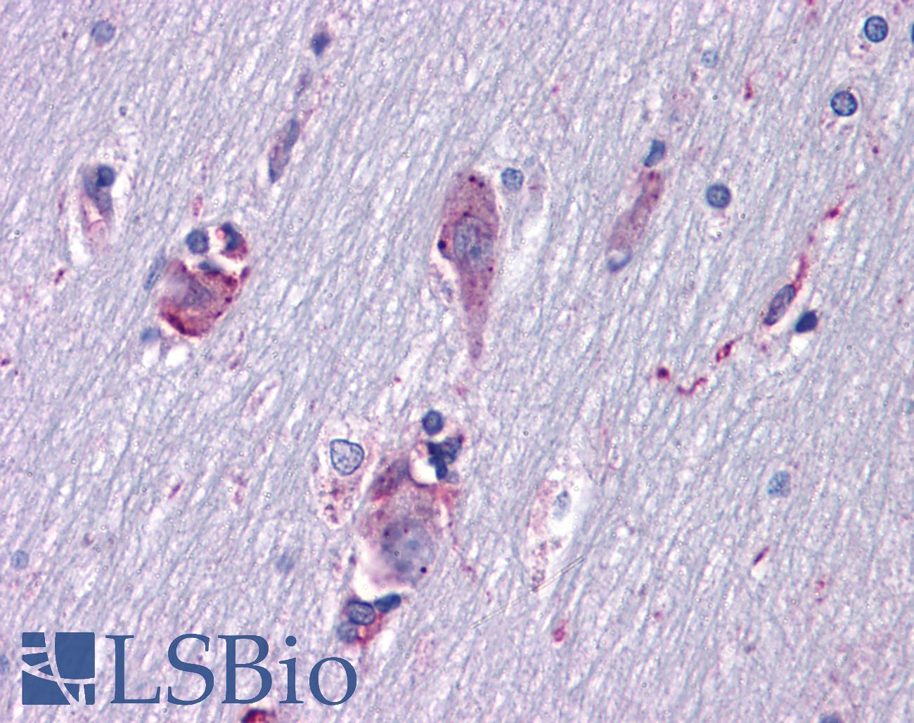 ISLET-1 / ISL1 Antibody - Anti-ISL1 / Islet 1 antibody IHC of human brain, cortex. Immunohistochemistry of formalin-fixed, paraffin-embedded tissue after heat-induced antigen retrieval. Antibody dilution 1:200.