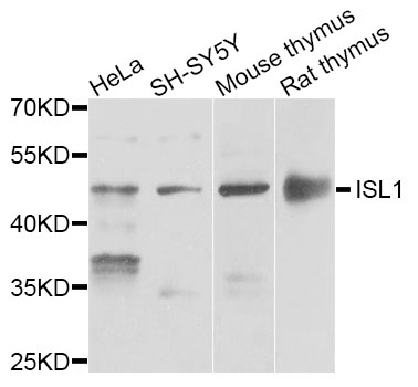 ISLET-1 / ISL1 Antibody - Western blot analysis of extracts of various cell lines.