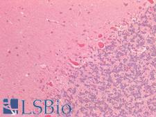 ISLET-1 / ISL1 Antibody - Human Brain, Cerebellum: Formalin-Fixed, Paraffin-Embedded (FFPE)