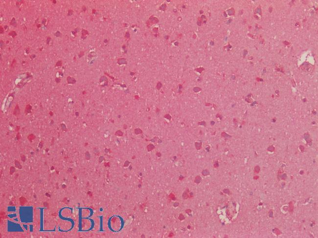ISLET-1 / ISL1 Antibody - Human Brain, Cortex: Formalin-Fixed, Paraffin-Embedded (FFPE)