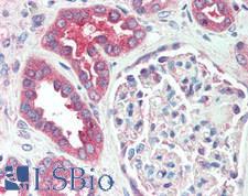 IST1 Antibody - Human Kidney: Formalin-Fixed, Paraffin-Embedded (FFPE)