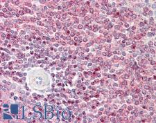 IST1 Antibody - Anti-IST1 antibody IHC staining of human spleen. Immunohistochemistry of formalin-fixed, paraffin-embedded tissue after heat-induced antigen retrieval.