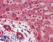 ITCH / AIP4 Antibody - Human Liver: Formalin-Fixed, Paraffin-Embedded (FFPE)