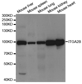 ITGA2B / CD41 Antibody - Western blot analysis of extracts of various cell lines, using ITGA2B antibody.