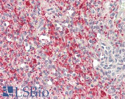 ITGA2B / CD41 Antibody - Human Spleen: Formalin-Fixed, Paraffin-Embedded (FFPE)