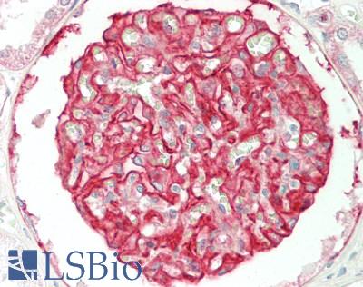 ITGA3 / CD49c Antibody - Human Kidney: Formalin-Fixed, Paraffin-Embedded (FFPE)