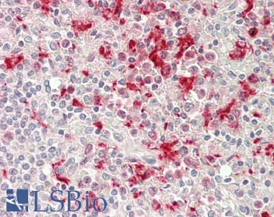 ITGA3 / CD49c Antibody - Human Spleen: Formalin-Fixed, Paraffin-Embedded (FFPE)