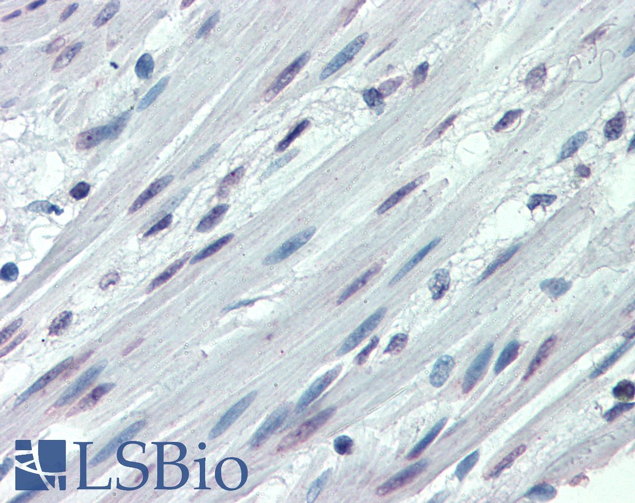 ITGA3 / CD49c Antibody - Anti-ITGA3 / CD49c antibody IHC of human colon, smooth muscle. Immunohistochemistry of formalin-fixed, paraffin-embedded tissue after heat-induced antigen retrieval.
