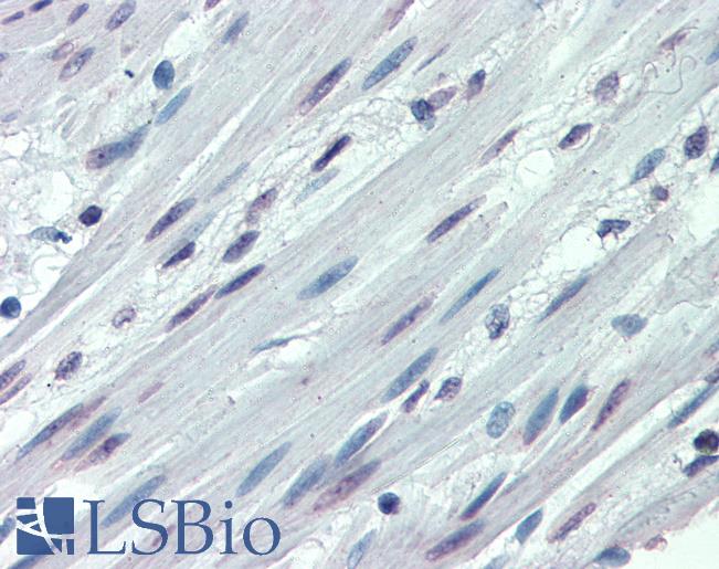 ITGA3 / CD49c Antibody - Anti-ITGA3 / CD49c antibody IHC of human colon, smooth muscle. Immunohistochemistry of formalin-fixed, paraffin-embedded tissue after heat-induced antigen retrieval.