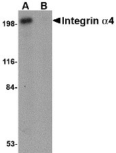 ITGA4 / VLA-4 / CD49d Antibody - Western blot of Integrin alpha 4 in Jurkat cell lysate with Integrin alpha 4 antibody at 1 ug/ml in (A) the absence and (B) the presence of blocking peptide.