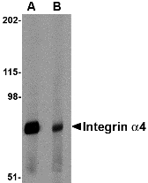 ITGA4 / VLA-4 / CD49d Antibody - Western blot of Integrin alpha 4 in rat spleen tissue lysate with Integrin alpha 4 antibody at 1 ug/ml in (A) the absence and (B) the presence of blocking peptide.
