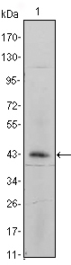 ITGA5/Integrin Alpha 5/CD49e Antibody - Western blot using ITGA5 mouse monoclonal antibody against ITGA5-hIgGFc transfected HEK293 cell lysate.